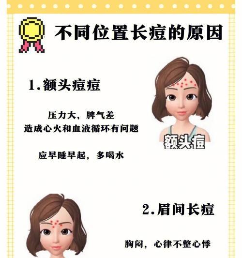 cf快速掉豆豆的方法有哪些？如何避免？  第2张